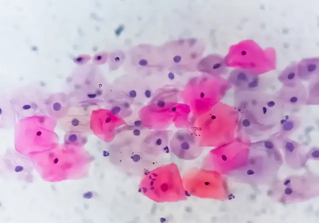 Dysplasiesprechstunde